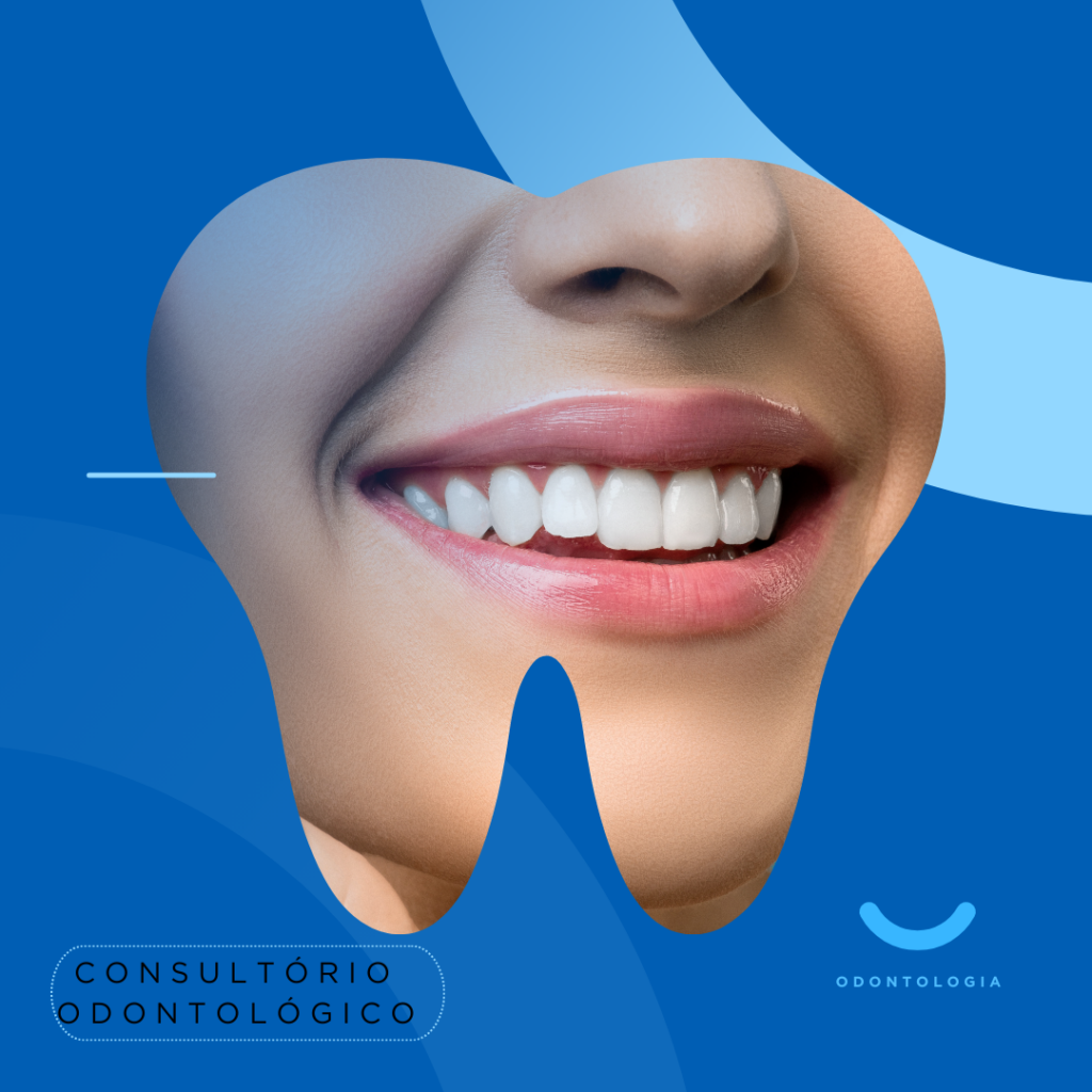 Post Para Instagram Seu Sorriso é Nossa Missão Odontologia Moderno Azul E Branco - Contábil Diretiva